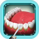 Odstranjevanje zobnega kamna